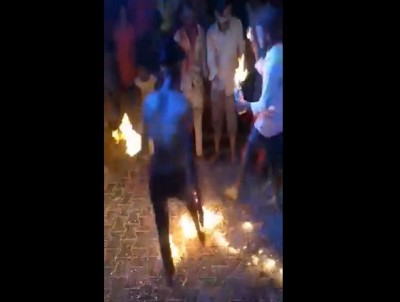Uttar Pradesh: Man performs fire breathing stunt goes horribly wrong