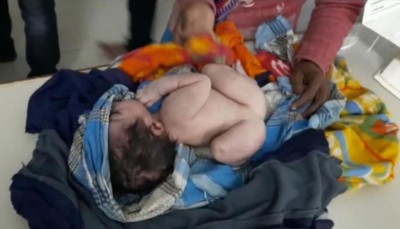 बिहार में हुआ अनोखे बच्चे का जन्म, देखकर चौंके लोग