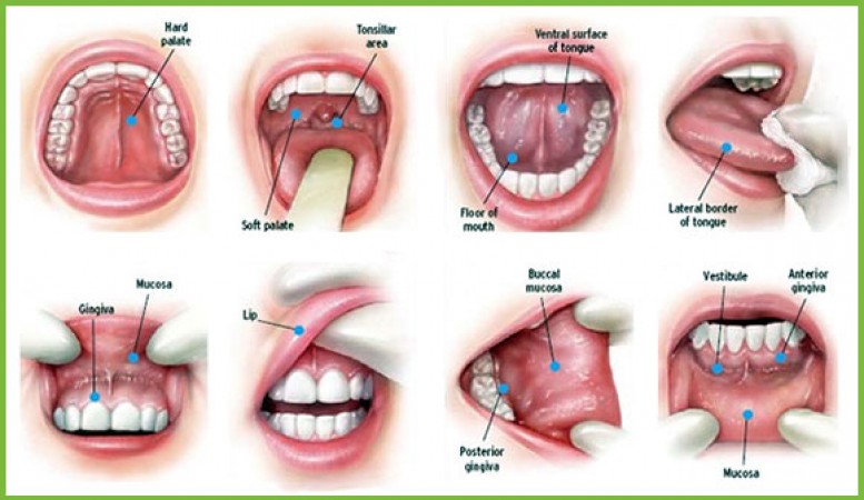 How mouth cancer occurs, know its symptoms, preventive measures and causes