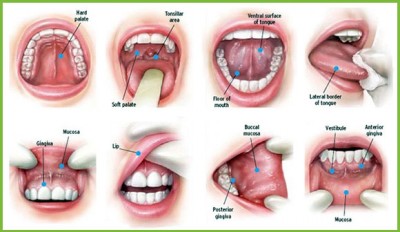 How mouth cancer occurs, know its symptoms, preventive measures and causes