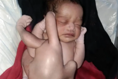 करीना ने 4 हाथ और 4 पैर वाले बच्चे को दिया जन्म, लोगों ने 'अवतार' से कर डाली तुलना
