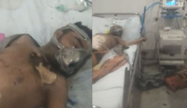 राजस्थान: ICU में भर्ती मरीज के मास्क में लगी आग तो भाग गया स्टाफ! हुई दर्दनाक मौत