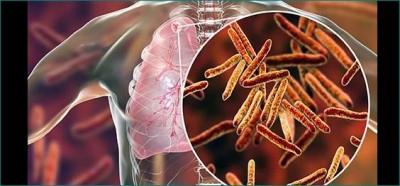 कोरोना संक्रमण और टीबी के मामलों को साथ नहीं जोड़ा जाना चाहिए: केंद्रीय स्वास्थ्य मंत्रालय