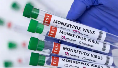 भारत में Monkeypox का तीसरा केस दर्ज, तीनों ही मरीज 'केरल' में मिले