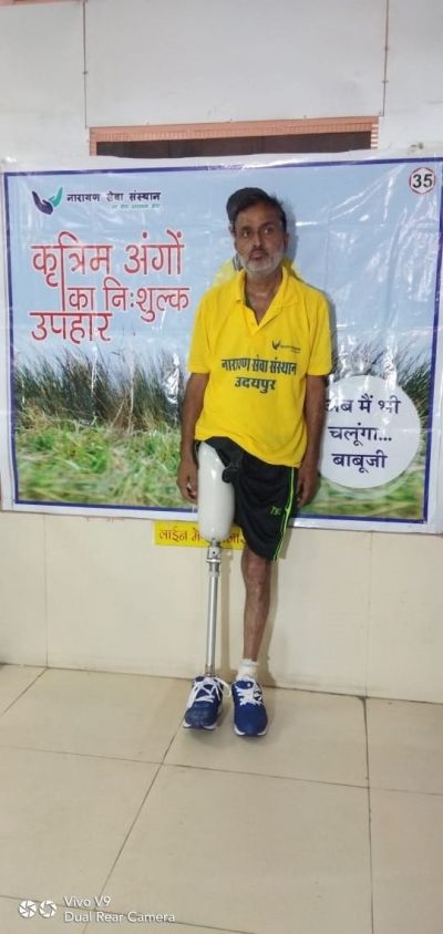 Narayan Seva Sansthan Launched Free Artificial Limb Distribution Camp
