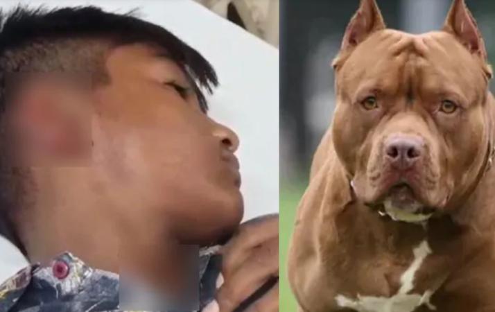 गुरदासपुर में भी लखनऊ जैसी घटना, 13 वर्षीय बच्चे का कान खा गया Pitbull