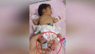 Parents fled after seeing this unique baby girl after birth, know why?