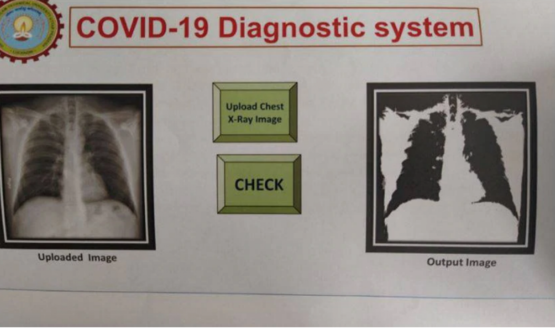 India's big success in war against Corona, now X-Ray machine will identify patient