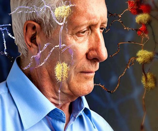 जानिए क्या है अल्जाइमर रोग के लक्षण