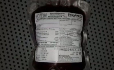 Bought blood for two and a half thousand to give the girl child, the doctor said - this is not blood at all...