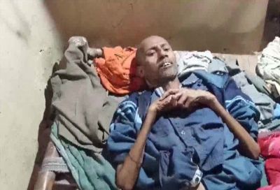Person starving from hunger for 6 days, suffering from TB