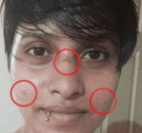 Friend shares 2-year-old photos of Shraddha's injured face