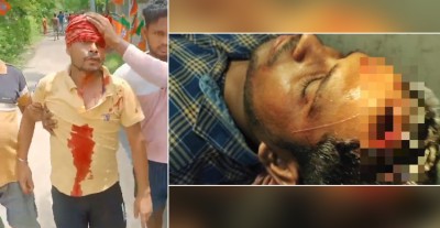 बंगाल में मतदान के बीच हिंसा जारी, पथराव में ANI पत्रकार का सिर फूटा, भाजपा कार्यकर्ता भी हुए लहूलुहान