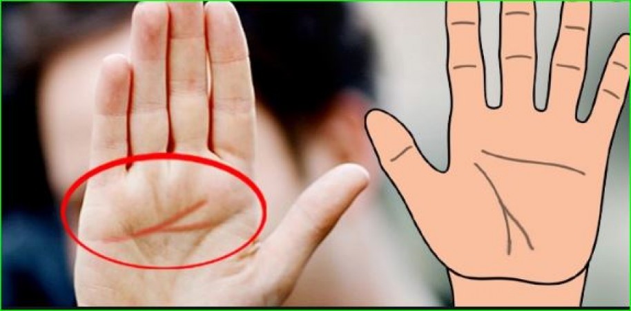 20 Wonderful Ways Xs on the back of your hands meaning with manual  