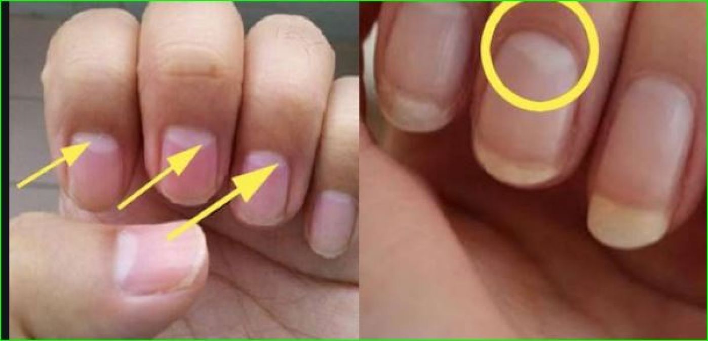 If you have this mark in your finger then your luck may progress