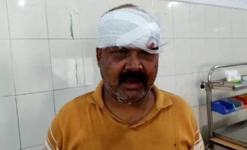 Muslim man brutally beaten up for praising Modi-Yogi, Babar Ali killed earlier