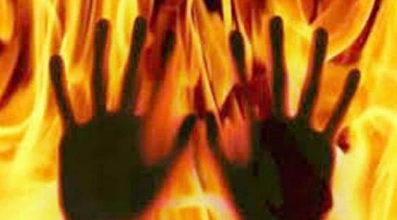 घरेलु विवाद में पति ने पत्नी को जिन्दा जलाया, 83 फीसद झुलसी महिला