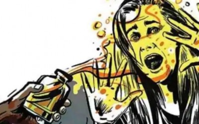 Lucknow: Mother-Son attacked with acid at home, both seriously injured