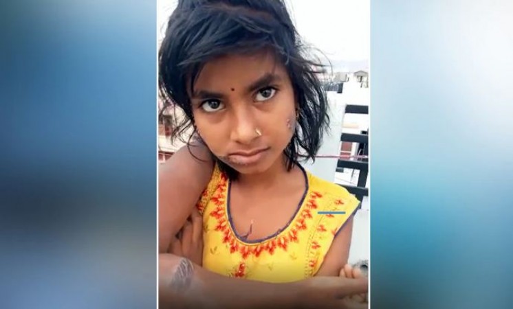 Bhabhi burned 13-year-old innocent with a hot knife, brother kept watching silently