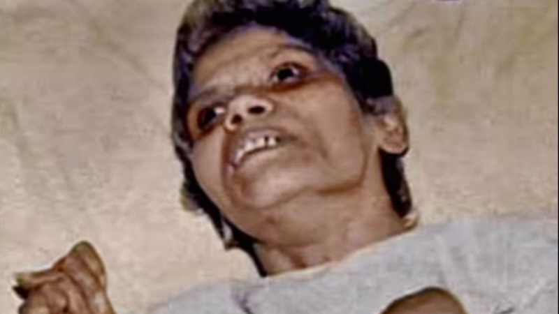 This woman was in coma for 42 years after rape, then in Kolkata rape ...?