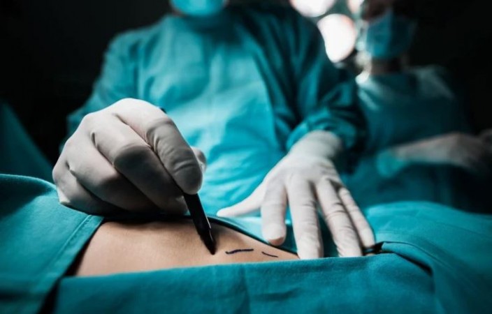 Doctor removes both kidneys of woman who went for operation, the case is shocking