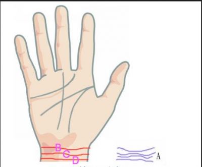Palmistry- Your palm tells much about your pregnancy problems…check inside detail with a pic