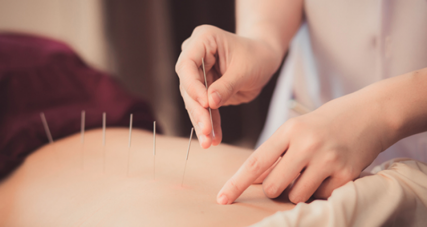 Know how acupuncture and acupressure are important parts of Hindu rituals?