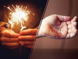 If your hands get burnt while doing fireworks, do not do this work even by mistake, know the doctor's advice