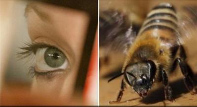 OMG! Doctors extracted three live bees from a woman's eye