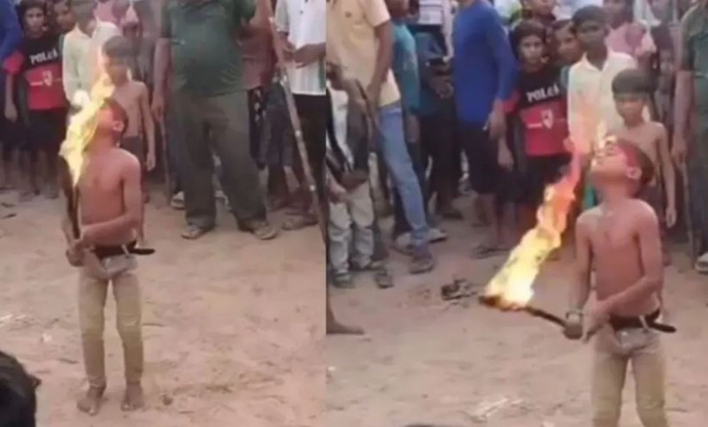 Child's Dangerous Fire Stunt Goes Wrong, Serves as Stark Reminder of Fire Safety