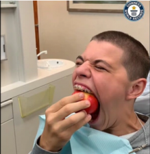 American teen sets Guinness World Record with 10 cm mouth