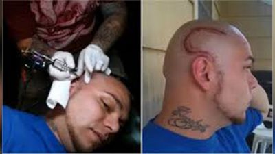 The Reason Why This Father Wanted To Have A Scar On His Head??