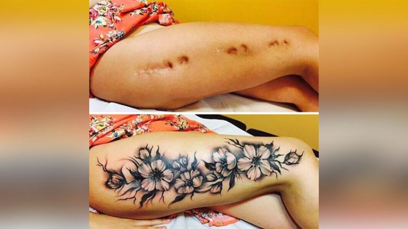 Tattooing is the nice trick to cover scars, see in pictures!