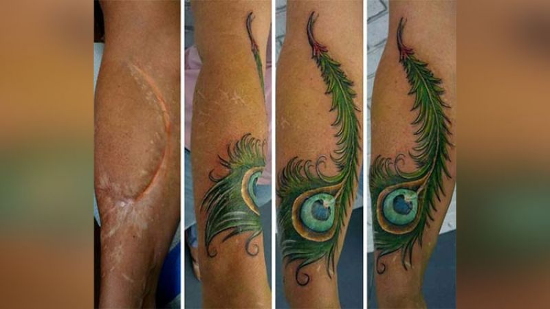 Tattooing is the nice trick to cover scars, see in pictures!