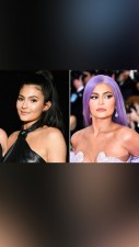 Kylie Jenner's shocking Transformation, Plastic surgeries or age-related developments