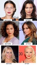 From Bella Hadid to Megan Fox, Hollywood celebrities shocking transformation after Plastic Surgery