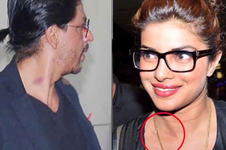Bollywood celebs caught by camera with their love bites!