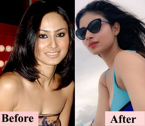 These 8 pictures shows-how Mouni Roy changed after cosmetic surgery !!!