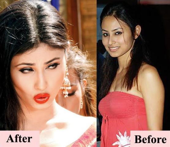 These 8 pictures shows-how Mouni Roy changed after cosmetic surgery !!!