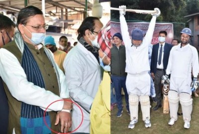 The Chief Minister got injured while playing cricket, got plaster after X-ray