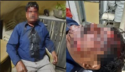 पंजाब में बीच सड़क पर अमर उजाला के पत्रकार पर जानलेवा हमला, लहूलुहान छोड़कर भागे बदमाश, सिर में लगे 27 टांके
