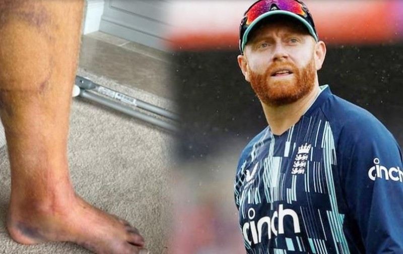 Jonny Bairstow fractures leg in three places, photos revealed