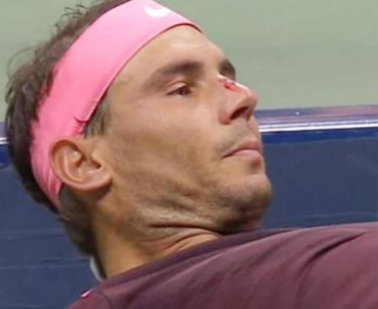 US Open: Rafael Nadal hits racquet on his own nose, blood starts flowing