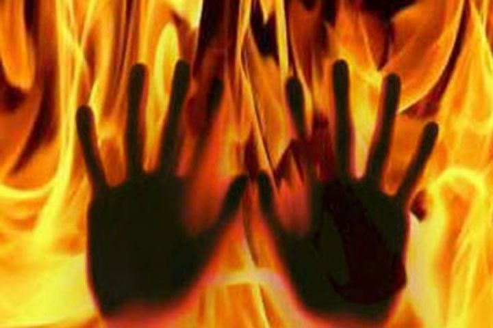 छेड़छाड़ से परेशान 10वी की छात्रा ने खुद को लगाई आग