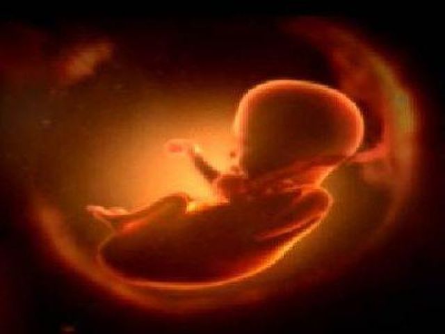 बच्चे के पेट से डाॅक्टरों ने निकाला भ्रूण