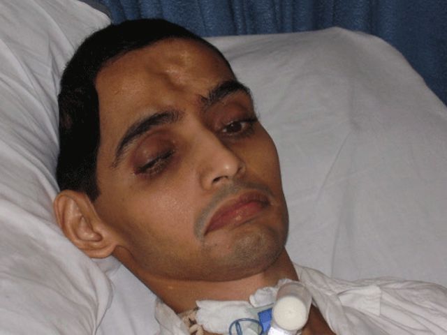 7/11 मुंबई धमाके में घायल शख्स ने आज ली अंतिम साँस