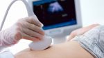भ्रूण परिक्षण करने वाली डॉक्टर गिरफ्तार, चलती गाड़ी में करती थी परीक्षण