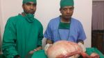 महिला के पेट से निकाला 22 किलो का ट्यूमर
