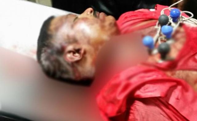 बेंगलुरु में आरएसएस कार्यकर्ता की हत्या