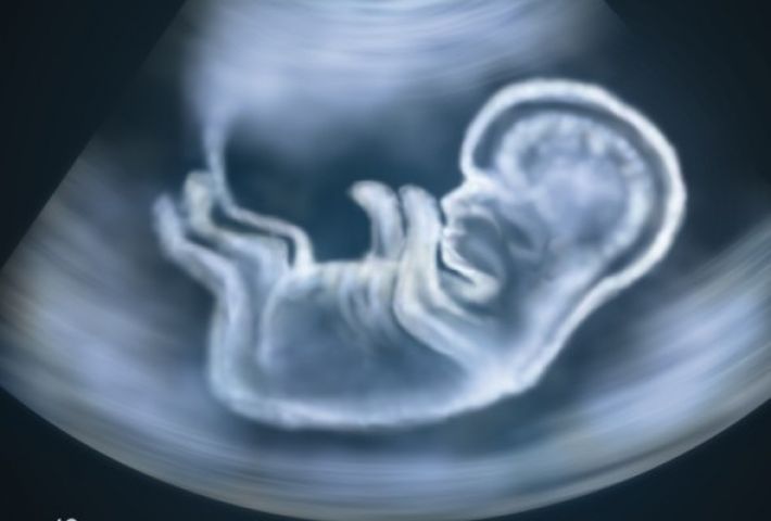 डॉक्टर ने कराया पत्नी का भ्रूण परीक्षण, फेसबुक पर अपलोड की फोटो